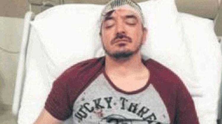 İstanbul'da dehşet: Ünlü sanatçı bıçaklandı!